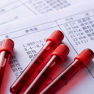 血药检测